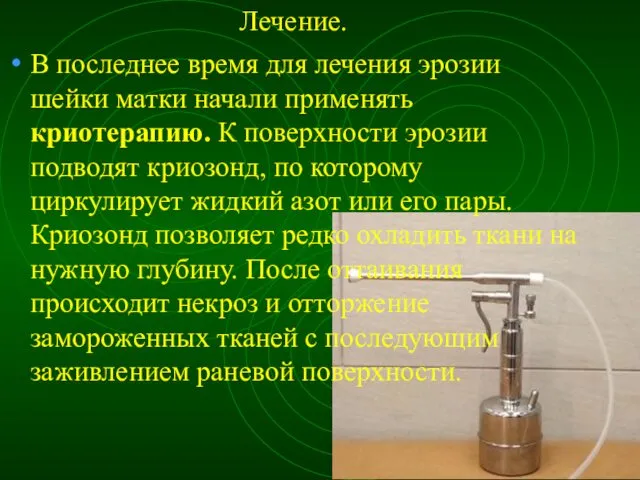 Лечение. В последнее время для лечения эрозии шейки матки начали применять