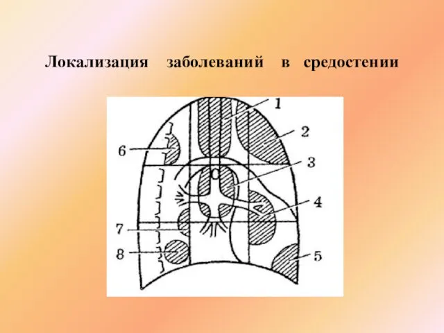 Локализация заболеваний в средостении