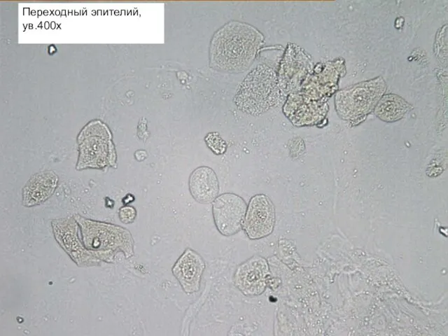 Переходный эпителий, ув.400х