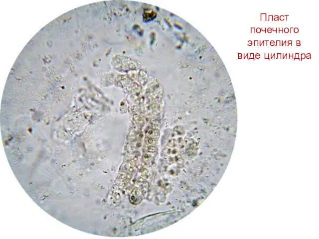 Пласт почечного эпителия в виде цилиндра