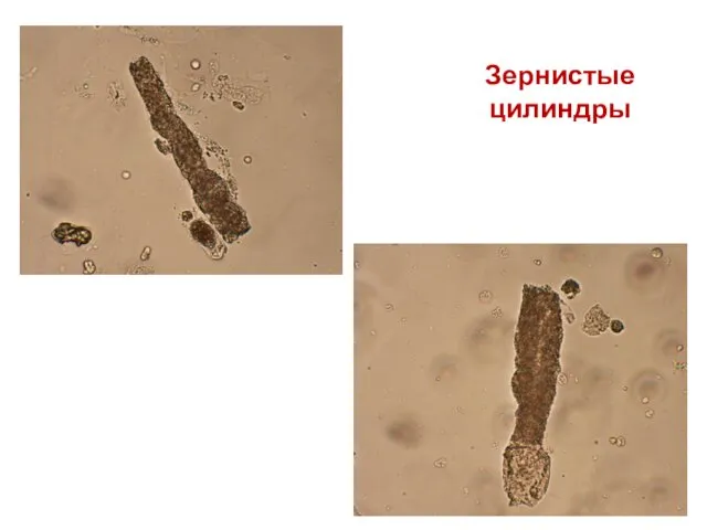 Зернистые цилиндры