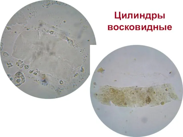 Цилиндры восковидные