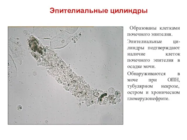 Образованы клетками почечного эпителия. Эпителиальные ци-линдры подтверждают наличие клеток почечного эпителия