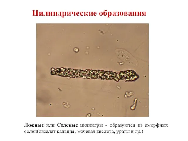 Ложные или Солевые цилиндры - образуются из аморфных солей(оксалат кальция, мочевая