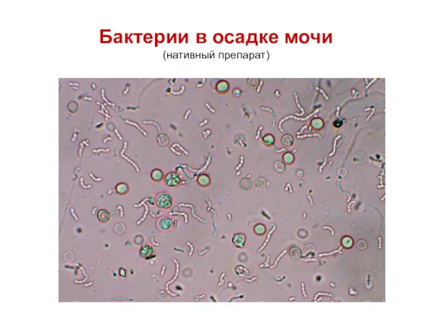 Бактерии в осадке мочи (нативный препарат)