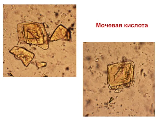 Мочевая кислота