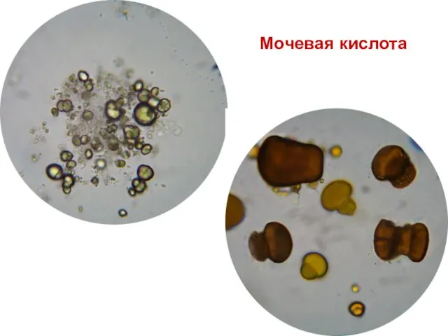 Мочевая кислота