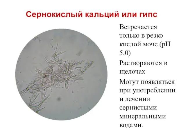 Сернокислый кальций или гипс Встречается только в резко кислой моче (рН