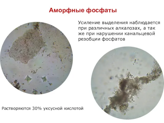 Аморфные фосфаты Растворяются 30% уксусной кислотой Усиление выделения наблюдается при различных