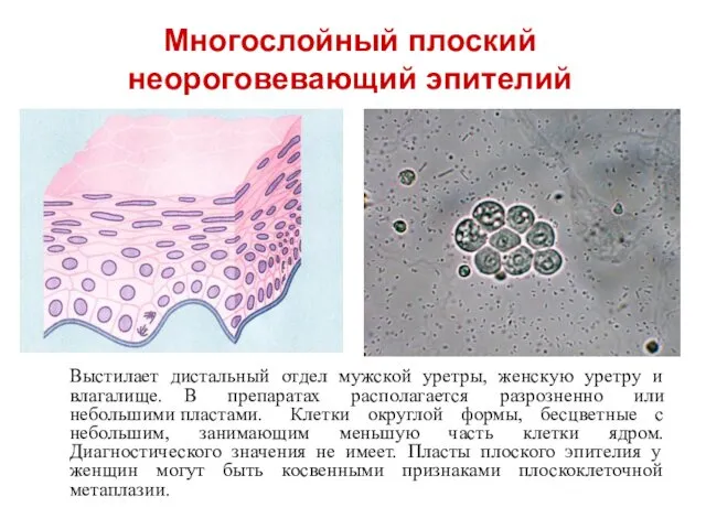 Выстилает дистальный отдел мужской уретры, женскую уретру и влагалище. В препаратах