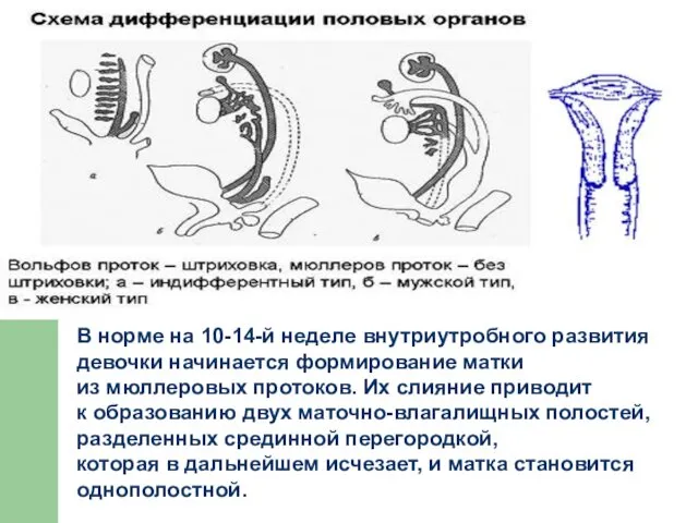 В норме на 10-14-й неделе внутриутробного развития девочки начинается формирование матки