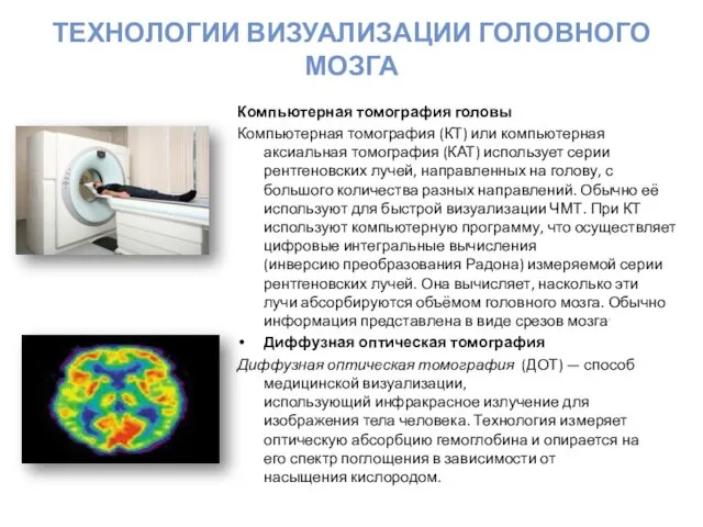 ТЕХНОЛОГИИ ВИЗУАЛИЗАЦИИ ГОЛОВНОГО МОЗГА Компьютерная томография головы Компьютерная томография (КТ) или