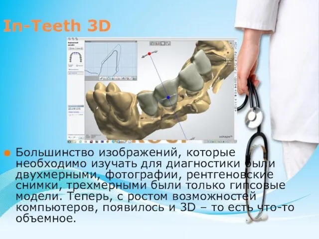 In-Teeth 3D Большинство изображений, которые необходимо изучать для диагностики были двухмерными,