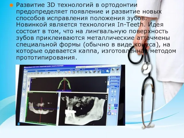 Развитие 3D технологий в ортодонтии предопределяет появление и развитие новых способов