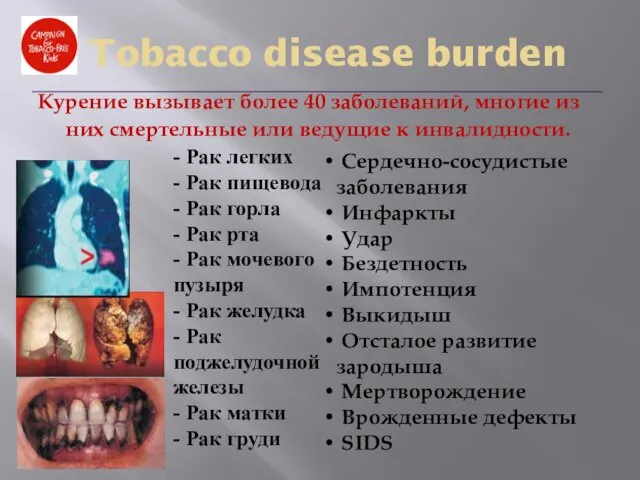 Курение вызывает более 40 заболеваний, многие из них смертельные или ведущие