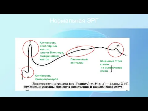 Нормальная ЭРГ Активность фоторецепторов Активность биполярных клеток, клеток Мюллера, амакриновых клеток