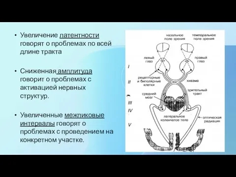 Увеличение латентности говорят о проблемах по всей длине тракта Сниженная амплитуда