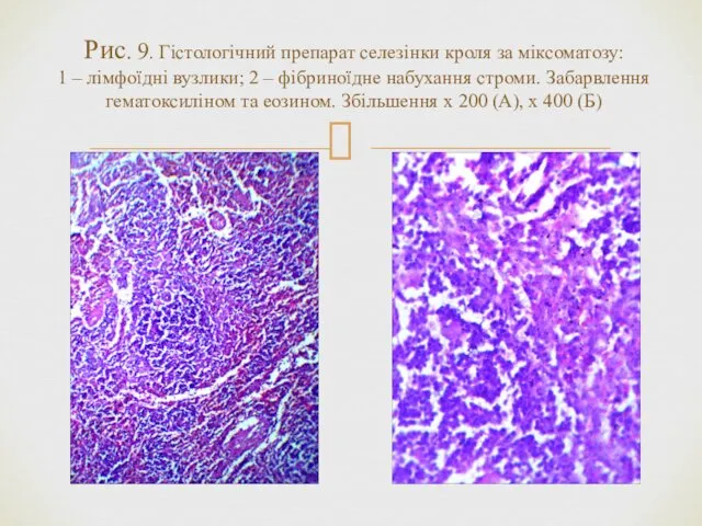 Рис. 9. Гістологічний препарат селезінки кроля за міксоматозу: 1 – лімфоїдні