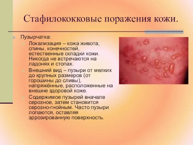 Стафилококковые поражения кожи. Пузырчатка: Локализация – кожа живота, спины, конечностей, естественные