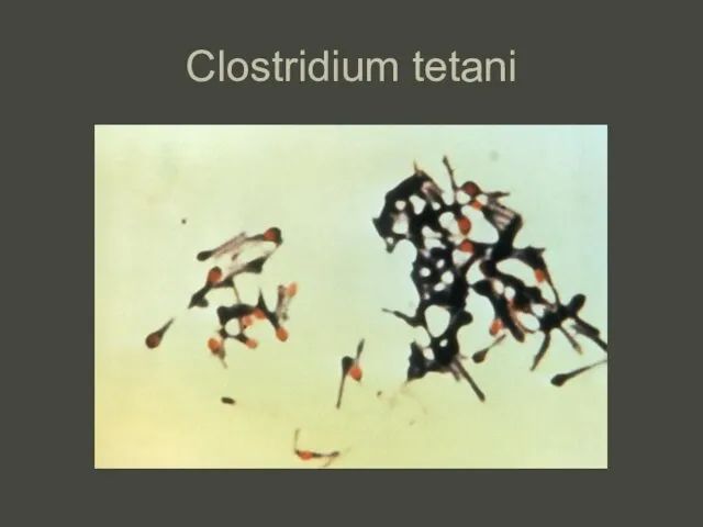 Clostridium tetani