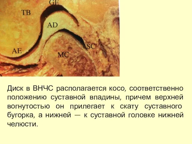 Диск в ВНЧС располагается косо, соответственно положению суставной впадины, причем верхней