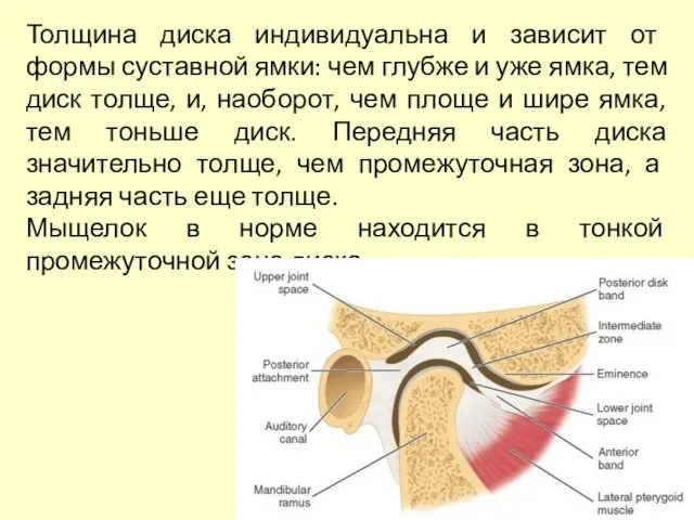 Толщина диска индивидуальна и зависит от формы суставной ямки: чем глубже