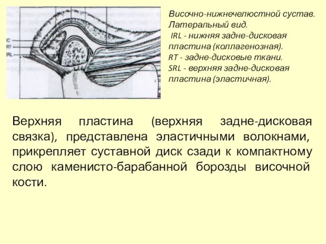 Височно-нижнечелюстной сустав. Латеральный вид. IRL - нижняя задне-дисковая пластина (коллагенозная). RT