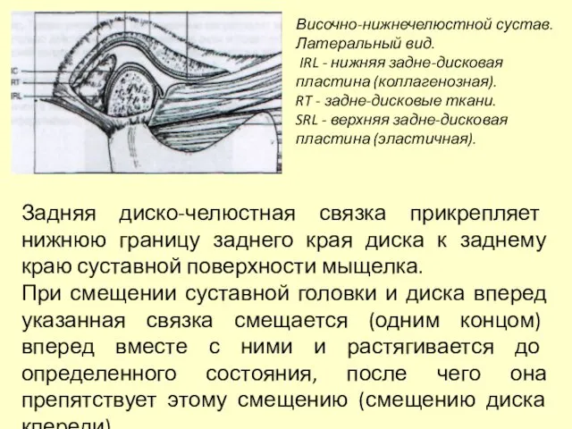 Височно-нижнечелюстной сустав. Латеральный вид. IRL - нижняя задне-дисковая пластина (коллагенозная). RT