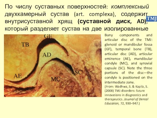 По числу суставных поверхностей: комплексный двухкамерный сустав (art. complexa), содержит внутрисуставной