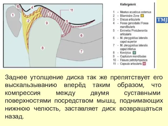 Заднее утолщение диска так же препятствует его выскальзыванию вперёд таким образом,