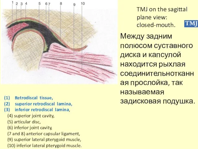 Retrodiscal tissue, superior retrodiscal lamina, inferior retrodiscal lamina, (4) superior joint