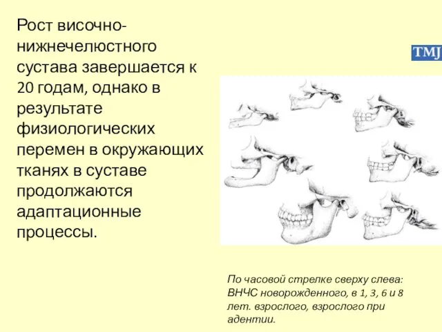 Рост височно-нижнечелюстного сустава завершается к 20 годам, однако в результате физиологических