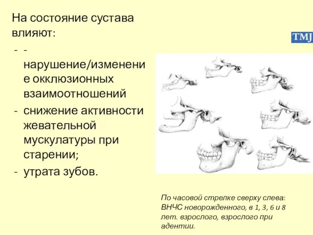 На состояние сустава влияют: -нарушение/изменение окклюзионных взаимоотношений снижение активности жевательной мускулатуры