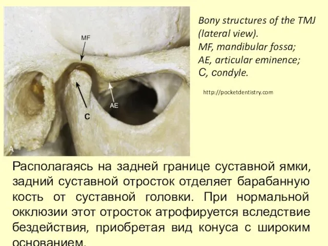 Bony structures of the TMJ (lateral view). MF, mandibular fossa; AE,