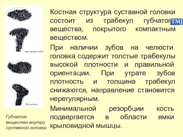 Костная структура суставной головки состоит из трабекул губчатого вещества, покрытого компактным