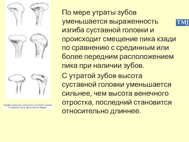 По мере утраты зубов уменьшается выраженность изгиба суставной головки и происходит