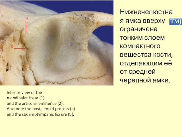 Inferior view of the mandibular fossa (1) and the articular eminence