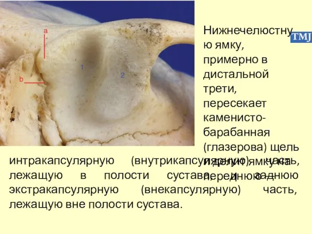 Нижнечелюстную ямку, примерно в дистальной трети, пересекает каменисто-барабанная (глазерова) щель и