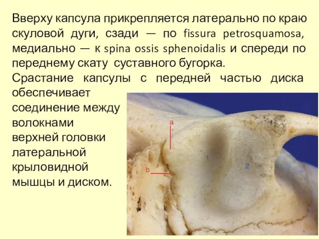 Вверху капсула прикрепляется латерально по краю скуловой дуги, сзади — по