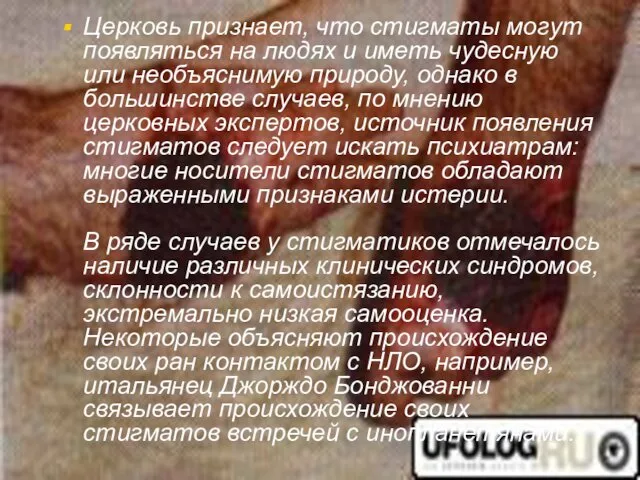 Церковь признает, что стигматы могут появляться на людях и иметь чудесную