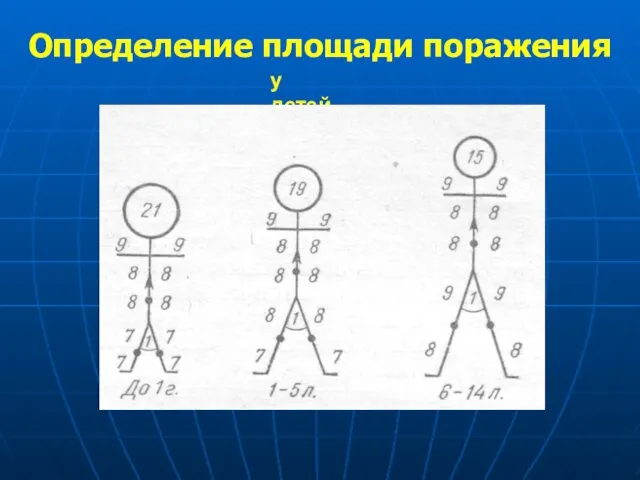 Определение площади поражения у детей