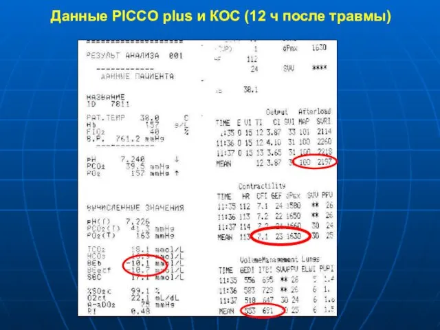 Данные PICCO plus и КОС (12 ч после травмы)