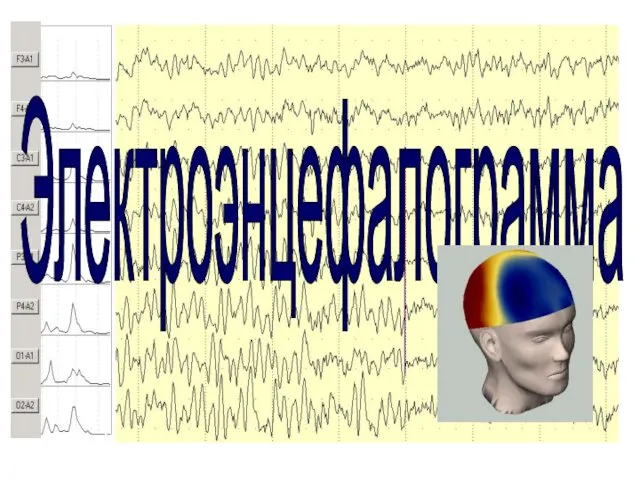 Электроэнцефалограмма