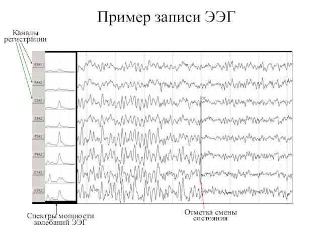Пример записи ЭЭГ Каналы регистрации Спектры мощности колебаний ЭЭГ Отметка смены состояния