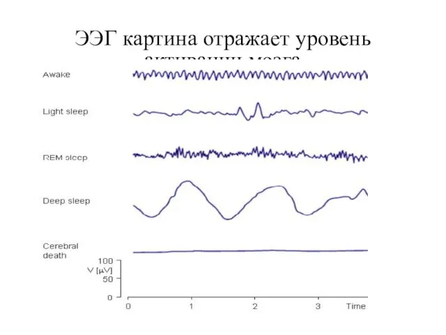 ЭЭГ картина отражает уровень активации мозга