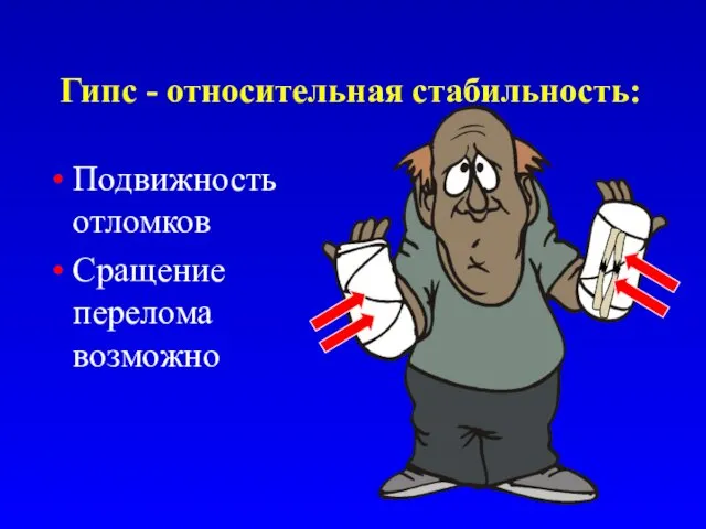 Гипс - относительная стабильность: Подвижность отломков Сращение перелома возможно