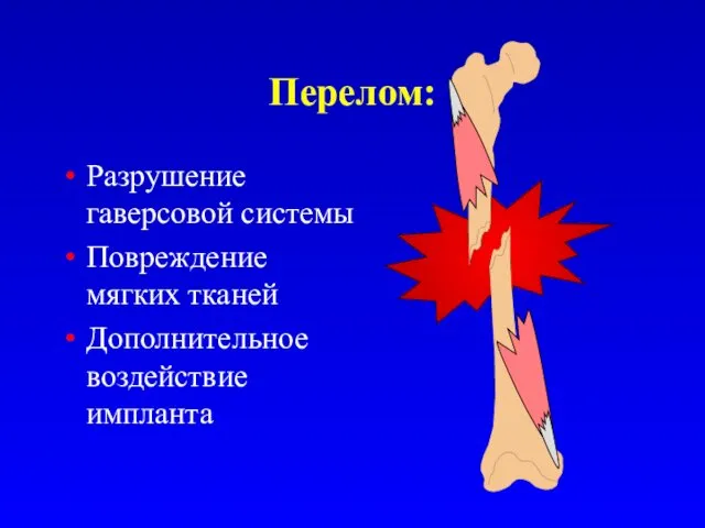 Перелом: Разрушение гаверсовой системы Повреждение мягких тканей Дополнительное воздействие импланта