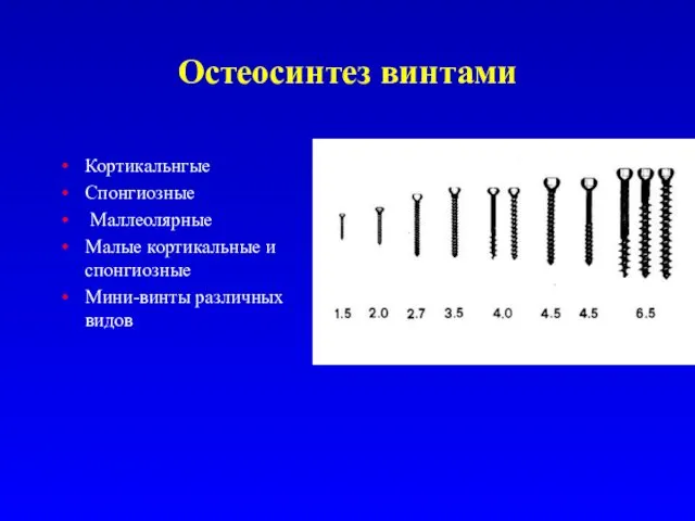 Остеосинтез винтами Кортикальнгые Спонгиозные Маллеолярные Малые кортикальные и спонгиозные Мини-винты различных видов