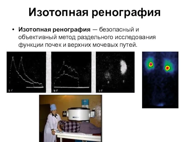 Изотопная ренография Изотопная ренография — безопасный и объективный метод раздельного исследования