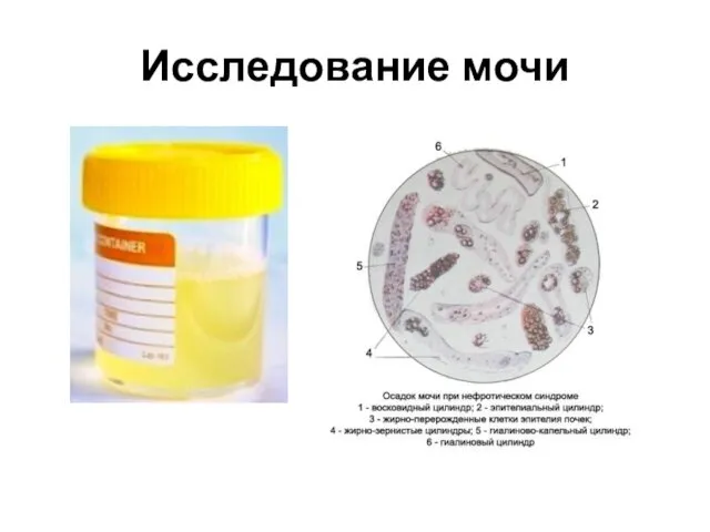 Исследование мочи